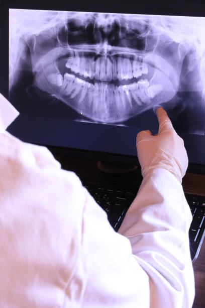 Best Knocked-Out Tooth Emergency  in Teague, TX